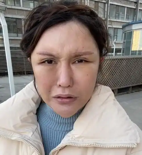 但即便偶像美娜这样整容失败的,可还是抵挡不住美容院的生意火爆,一个