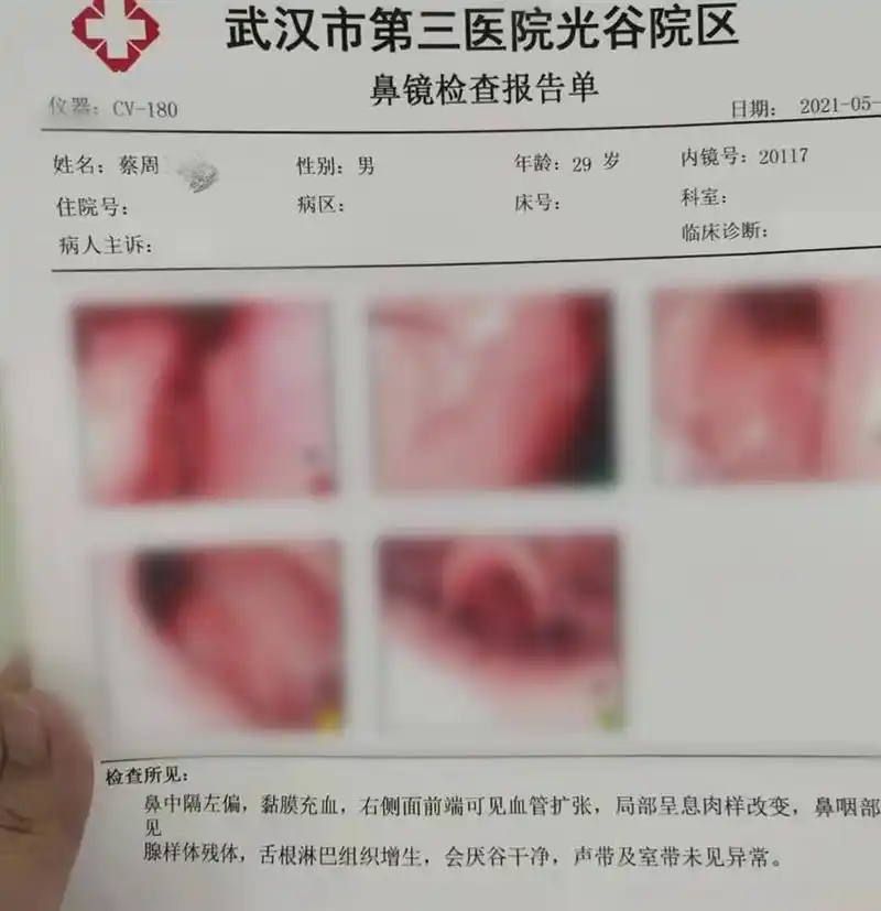 顾客刚办卡就反悔,店家要扣除20%手续费,律师:合同