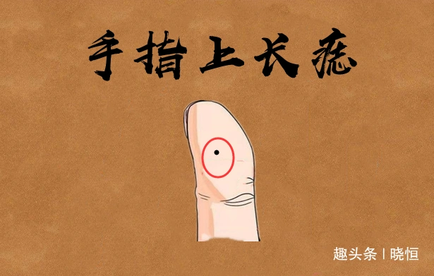 身体6颗暴富痣,非富即贵,生意红火不差钱,个个腰缠万贯