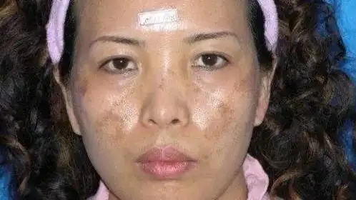 子宫"脏兮兮"的女生脸上5大征兆,警惕占上摊大事!原创 梅子 2020-3-30