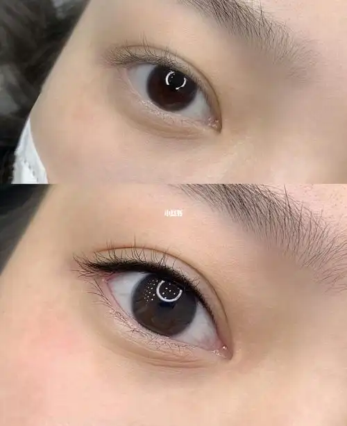 "亮眸美瞳黑"操作前90后效果对比来咯～_美瞳_美瞳线_美妆_医美整形