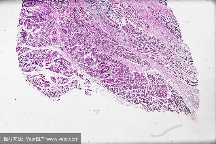 显微镜下人体骨骼肌病理标本的萎缩