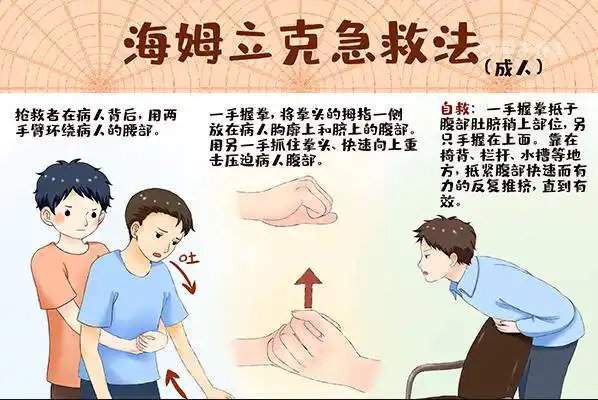 海姆立克急救法的详细步骤