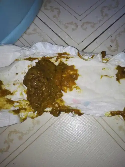 孩子19个月,四天前喝了一袋没热的牛奶,过了一小