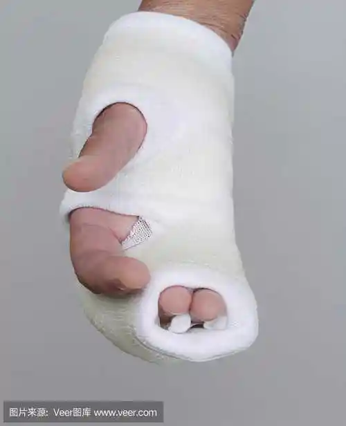 手部绷带八字包扎法,常用的开放伤口的包扎方