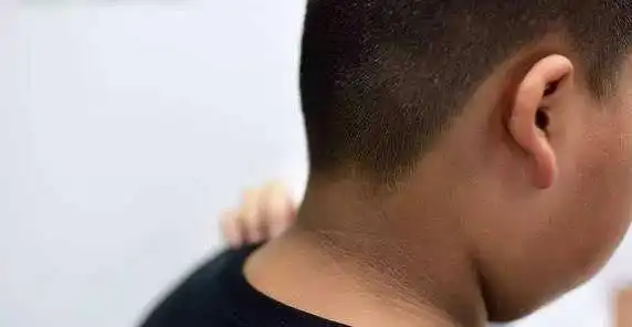 耳朵发黑中医讲肾开窍于耳,因而耳朵的变化可以说肾