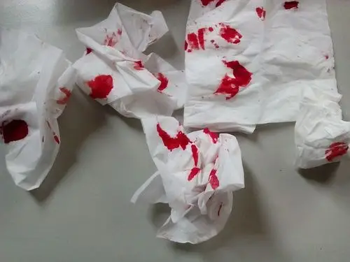 无缘故血流不止,是不是老了?