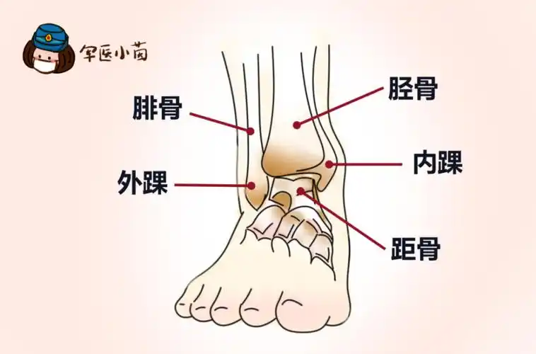 1在内踝尖至胫骨远端 6cm 的后内侧面有骨压痛;2在外踝尖至腓骨远端