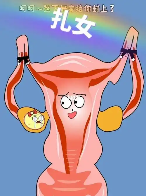 女性结扎演示04