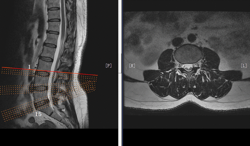 mri摆位,我不信你真的会!