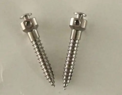 矫正牙齿钢钉图片