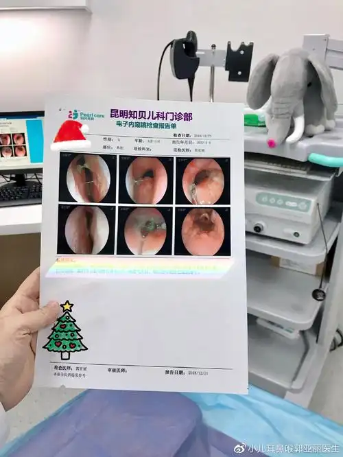 检查后对于鼻腔疾病一目了然;反复,迁延不愈的咳嗽,清嗓,是儿童鼻窦炎