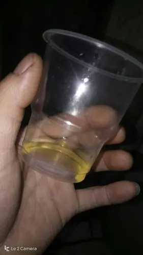 我的尿液这么黄正常吗