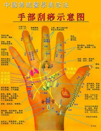 中医刮痧的基本方法