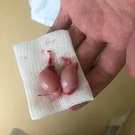 讨论那个想看看大家崽崽绝育割下来的蛋蛋图片有蛋蛋图慎入