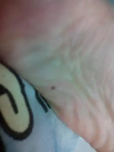 小孩子脚底板有至.意为着什么?