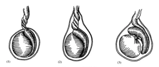 男宝宝的蛋蛋不对称正常吗宝宝的蛋蛋不对称怎么办