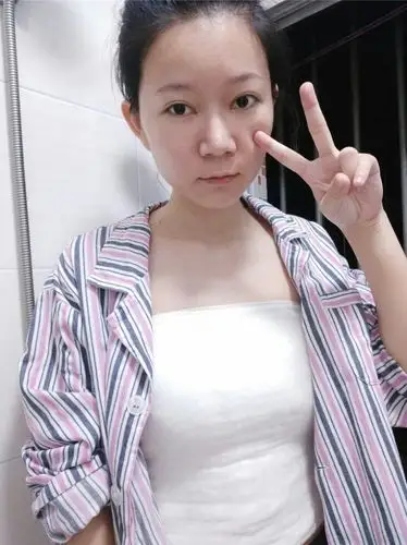 【假体隆胸第4天】