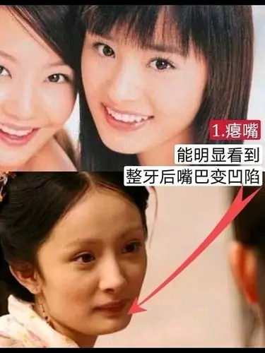 杨幂zu|不该d_圈子-新氧美容整形