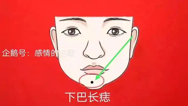 进财痣,身体5颗吉痣,福气找上门,马上发大财,日子红红火火!