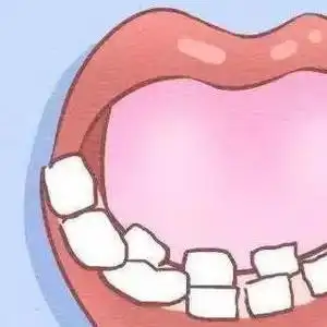 双排牙会自动归位吗