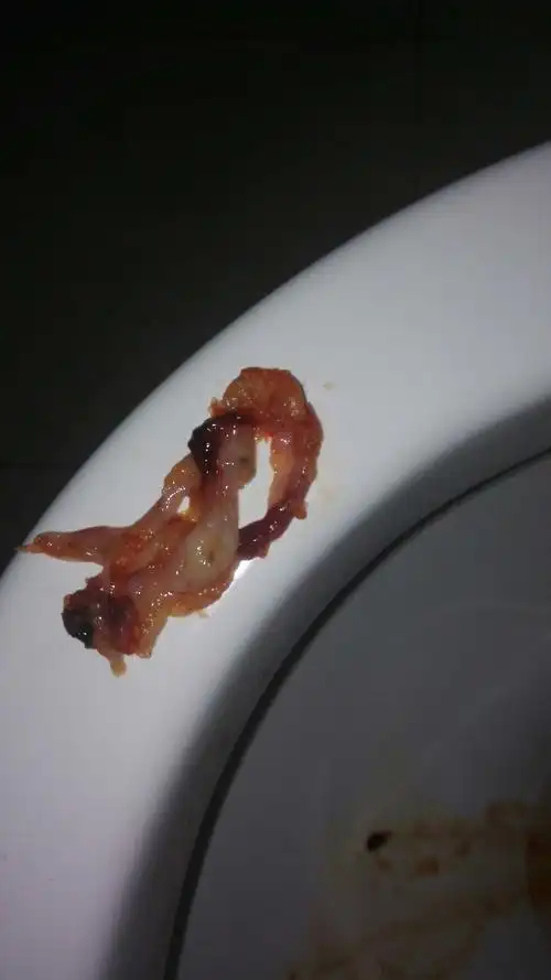 感觉肚子疼,一上厕所就有东西流出来了,这到底是怎么回事呀?