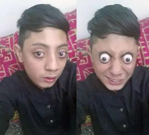 吓到「眼珠子」掉出来是真的!