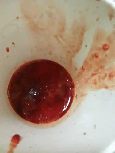 像这样吐血严重不