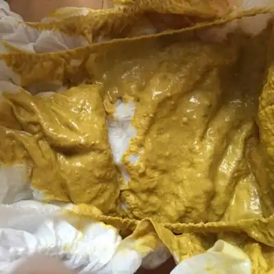 宝宝连着4天拉这样的粑粑,稀糊的,正常吗?