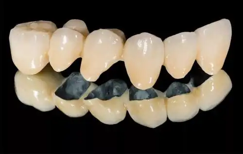 一字之差丨烤瓷牙和全瓷牙如何选择