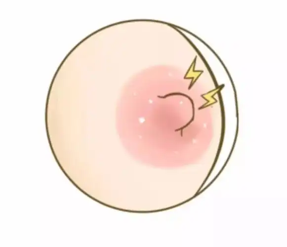 cu妈妈母乳乳头小白点怎么破马上教教你