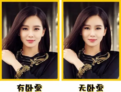 年轻十岁割眼袋是一种怎样的体验