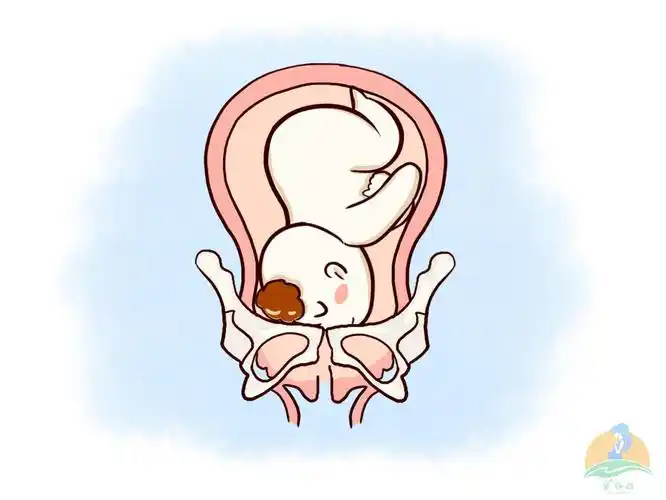 真才实学! 胎儿臀位 "谁知孤负李陵心"-第2张图片-融科博客