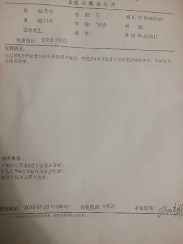 右脚第五个脚趾头骨折第四个脚趾头疑似骨折 请问吃什么辅助药物治疗