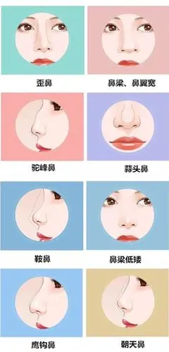 你是什么类型的鼻子对号入座