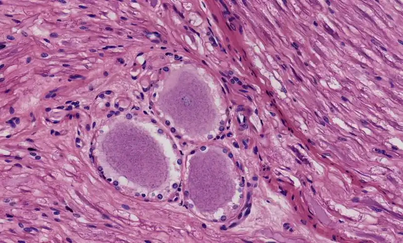 在脊神经节中,有神经元及包绕在周围的卫星细胞.对该图的描述下列哪.