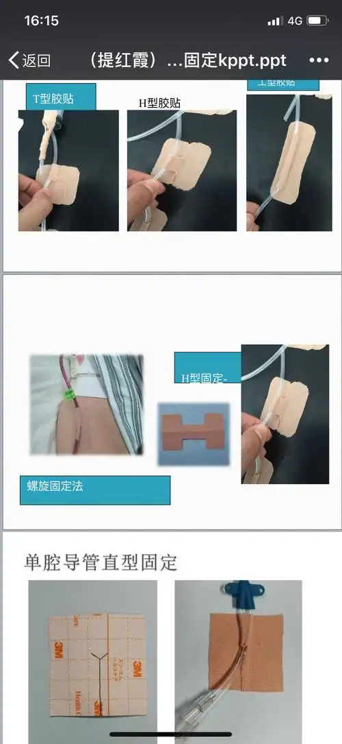 守护者——护理部11月份三基三严培训:各种常见引流管的护理及固定