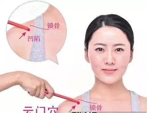 定位:胸前壁外上方,肩胛骨喙突上方,锁骨下窝(胸大肌与三角肌之间)