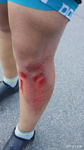 你第一次公路车摔车是大约多少公里之后