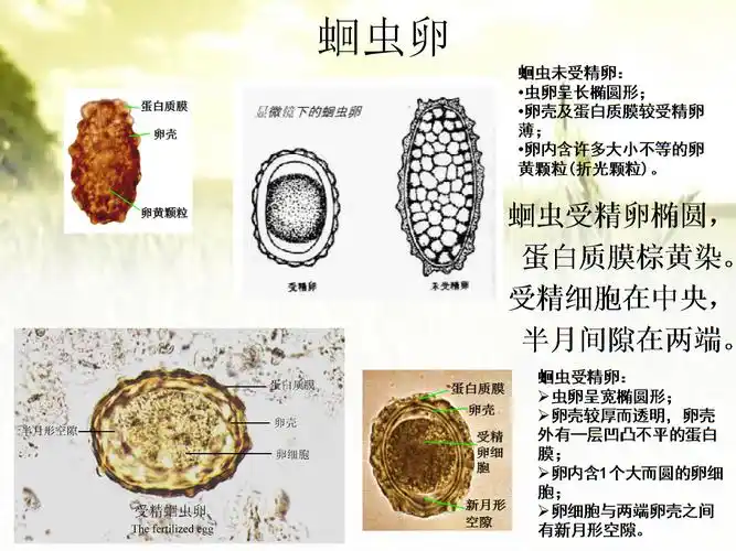 寄生虫学虫卵经典总结及图片.ppt