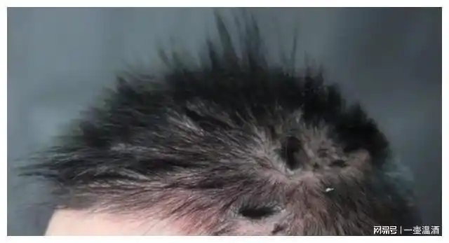 头上有大量头皮怎么办(头上有很多头皮该怎么办)