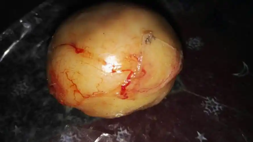 网传"鸭宝"1克值8万?专家:都是结石食用有害