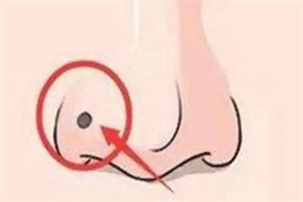 刀厄是什么意思 刀厄是灾相的代表