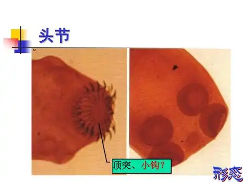 2010绦虫概论,猪带,牛带ppt