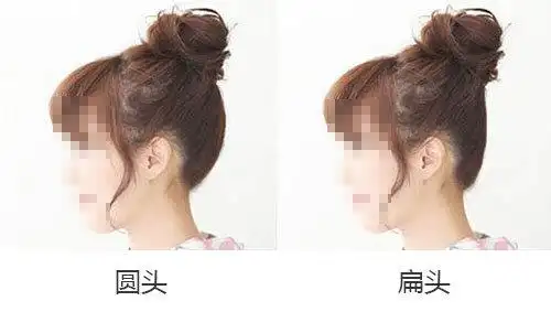 扁头和圆头有什么区别?骨水泥打造圆润的后脑勺有何优势被大家推崇?