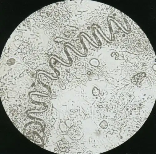 粪便形态学图谱,检验人记得收藏|形态学|白细胞|红细胞|图谱|粪便
