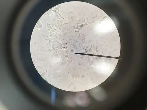 1,白带湿片里面的白细胞怎么看,这个片子能标注一下吗?