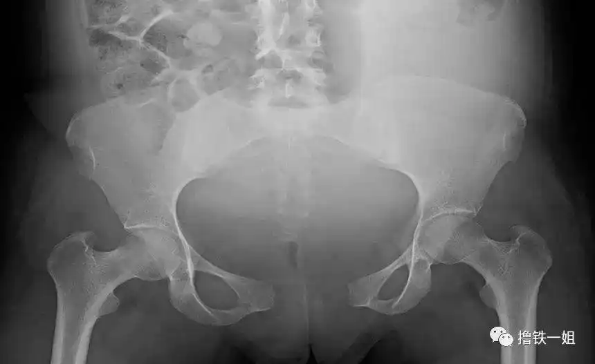 这是郭碧婷脸胖了一圈巨大孕妇装也难掩孕味