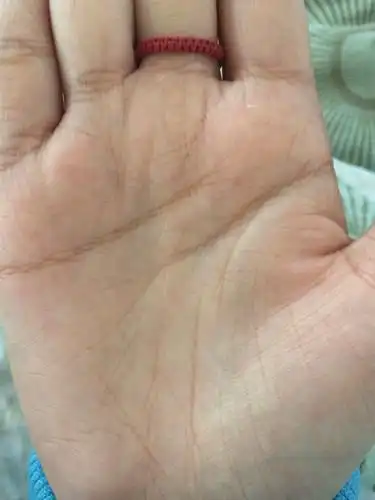 只是好奇 为什么别人的生命线是一条下来的 我的断开还错位嘞 急求