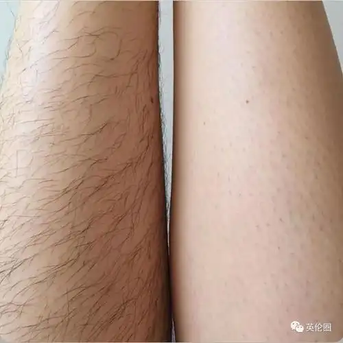 这个英国妹子带头1月不剃毛,全世界女人都坐不住了